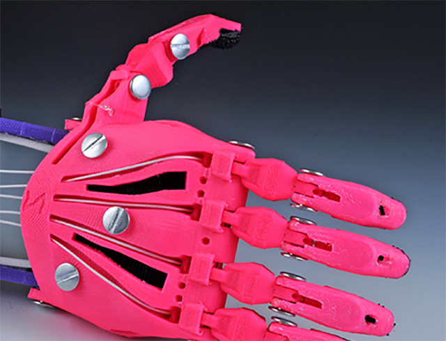 The artificial “hand” that designer Frankie Flood and his team created with a 3-D printer enables 10-year-old Shea Stollenwerk to perform everyday tasks more easily.